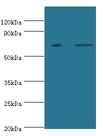 Poly(A)-specific ribonuclease PARN Polyclonal Antibody