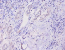 Prohibitin Polyclonal Antibody