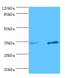 Urokinase plasminogen activator surface receptor Polyclonal Antibody