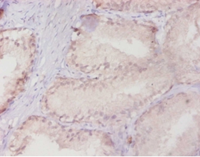 Ras-related protein Rab-10 Polyclonal Antibody