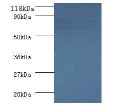 Succinate dehydrogenase [ubiquinone] flavoprotein subunit, mitochondrial Polyclonal Antibody