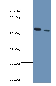 RNF8 Polyclonal Antibody