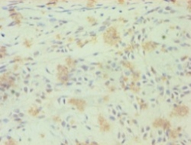 Nuclear receptor ROR-gamma Polyclonal Antibody