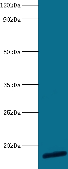 60S ribosomal protein L30 Polyclonal Antibody