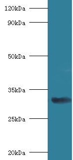 40S ribosomal protein SA Polyclonal Antibody