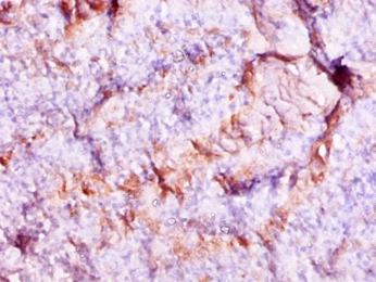 Protein S100-A9 Polyclonal Antibody