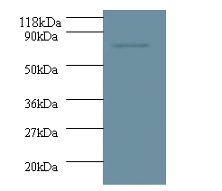 Deoxynucleoside triphosphate triphosphohydrolase SAMHD1 Antibody