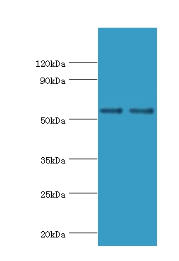 SLC2A1 Polyclonal Antibody