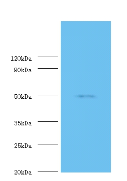 Mothers against decapentaplegic homolog 3 Polyclonal Antibody