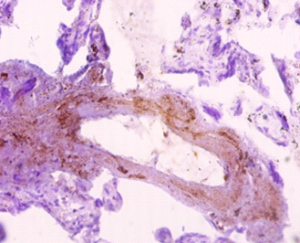 Sorting nexin-20 Polyclonal Antibody