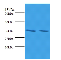 Sorting nexin-20 Polyclonal Antibody