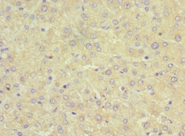 SRI Polyclonal Antibody