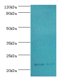 SRI Polyclonal Antibody