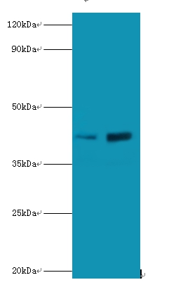 Lupus La protein Polyclonal Antibody