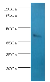 SSTR4 Polyclonal Antibody