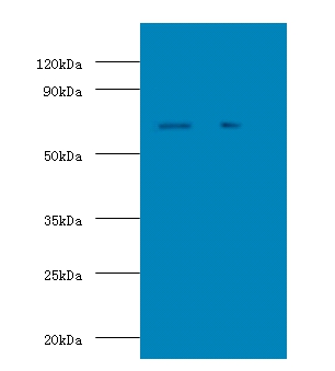 Stress-induced-phosphoprotein 1 Polyclonal Antibody