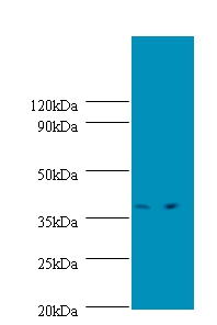 Transcription initiation protein SPT3 homolog Polyclonal Antibody