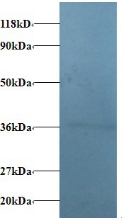 V-type proton ATPase subunit E 1 Polyclonal Antibody