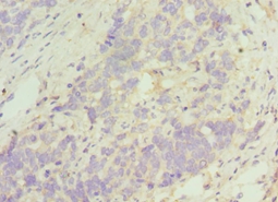 TACR3 Polyclonal Antibody