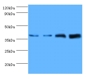 Tubulin-specific chaperone C Polyclonal Antibody