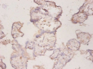 Toll-like receptor 7 Polyclonal Antibody