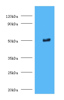 Trimethyllysine dioxygenase, mitochondrial Polyclonal Antibody