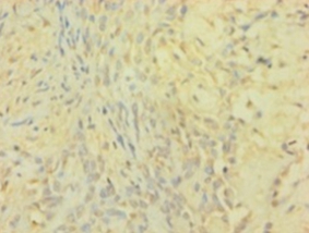 Metalloproteinase inhibitor 1 Polyclonal Antibody