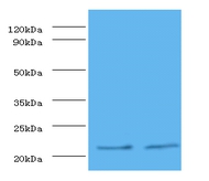 Metalloproteinase inhibitor 1 Polyclonal Antibody