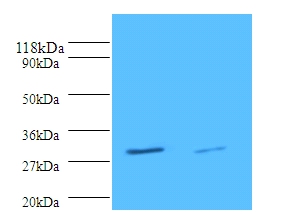 Tryptase beta-2 Polyclonal Antibody