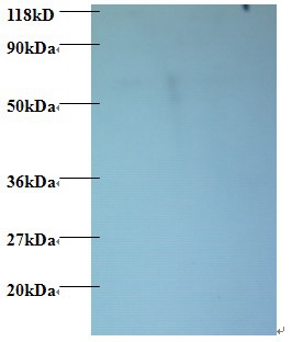 60S ribosomal protein L15 Polyclonal Antibody