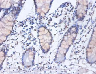 Heterogeneous nuclear ribonucleoprotein D0 Polyclonal Antibody