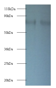 40S ribosomal protein S10 Polyclonal Antibody