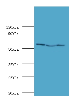 Ubiquitin carboxyl-terminal hydrolase 14 Polyclonal Antibody