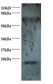 Small nuclear ribonucleoprotein Sm D2 Polyclonal Antibody