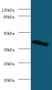 Galectin-9 Polyclonal Antibody