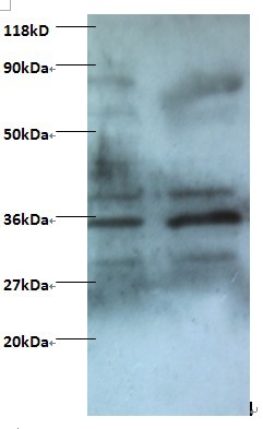 Zinc finger BED domain-containing protein 1 protein Polyclonal Antibody