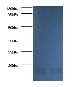 Nucleoside diphosphate kinase A Polyclonal Antibody