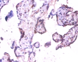 Exostosin-like 3 Polyclonal Antibody