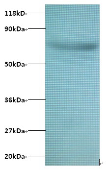 Actin-related protein 2/3 complex subunit 3 Polyclonal Antibody