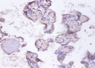 Heterogeneous nuclear ribonucleoprotein Q Polyclonal Antibody