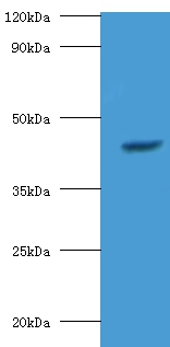 StAR-related lipid transfer protein 7, mitochondrial Polyclonal Antibody