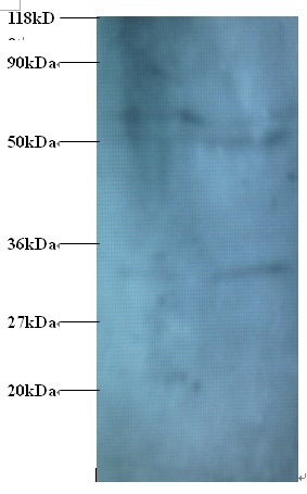 Zinc finger protein 384 Polyclonal Antibody