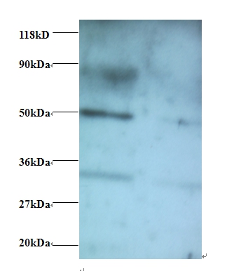 Vesicular, overexpressed in cancer, prosurvival protein 1 Polyclonal Antibody