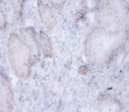 AFG3-like protein 2 Polyclonal Antibody