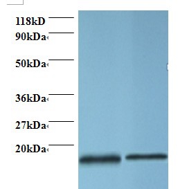 Profilin-1 Polyclonal Antibody