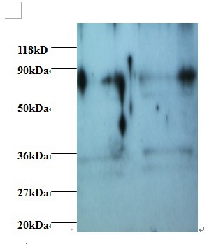 Heterogeneous nuclear ribonucleoprotein H Polyclonal Antibody