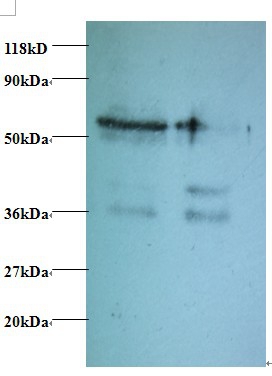 Tax1-binding protein 3 Polyclonal Antibody