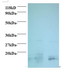 Charged multivesicular body protein 2a Polyclonal Antibody