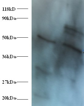 Dolichyl-diphosphooligosaccharide--protein glycosyltransferase 48 kDa subunit Polyclonal Antibody