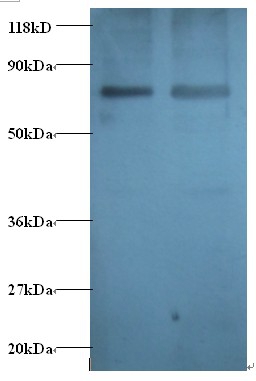 Gamma-aminobutyric acid receptor-associated protein Polyclonal Antibody